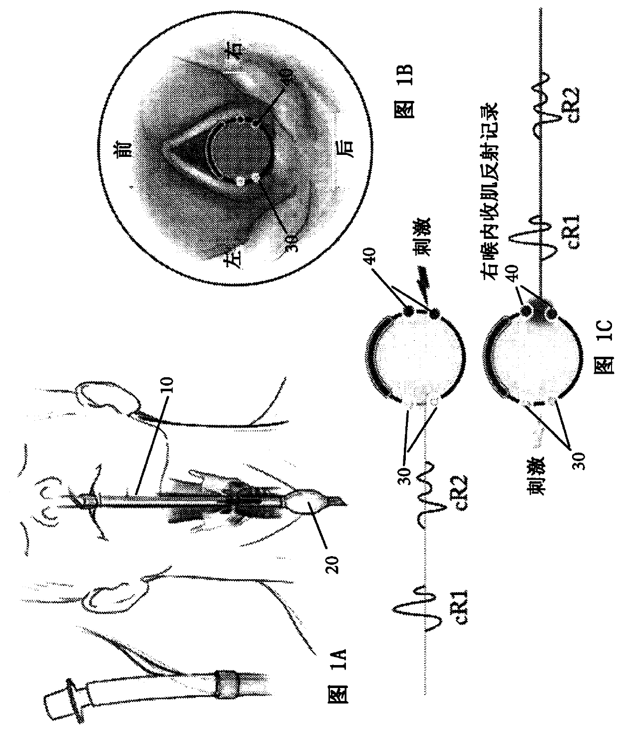 Method and system for assessing laryngeal and vagus nerve integrity in patients under general anesthesia