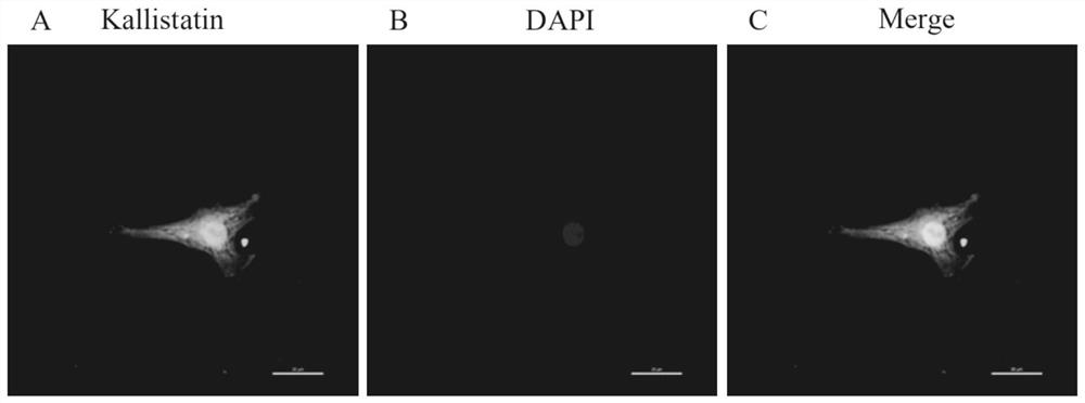 Diagnosis marker kallistatin for ovarian hyperstimulation syndrome and its application