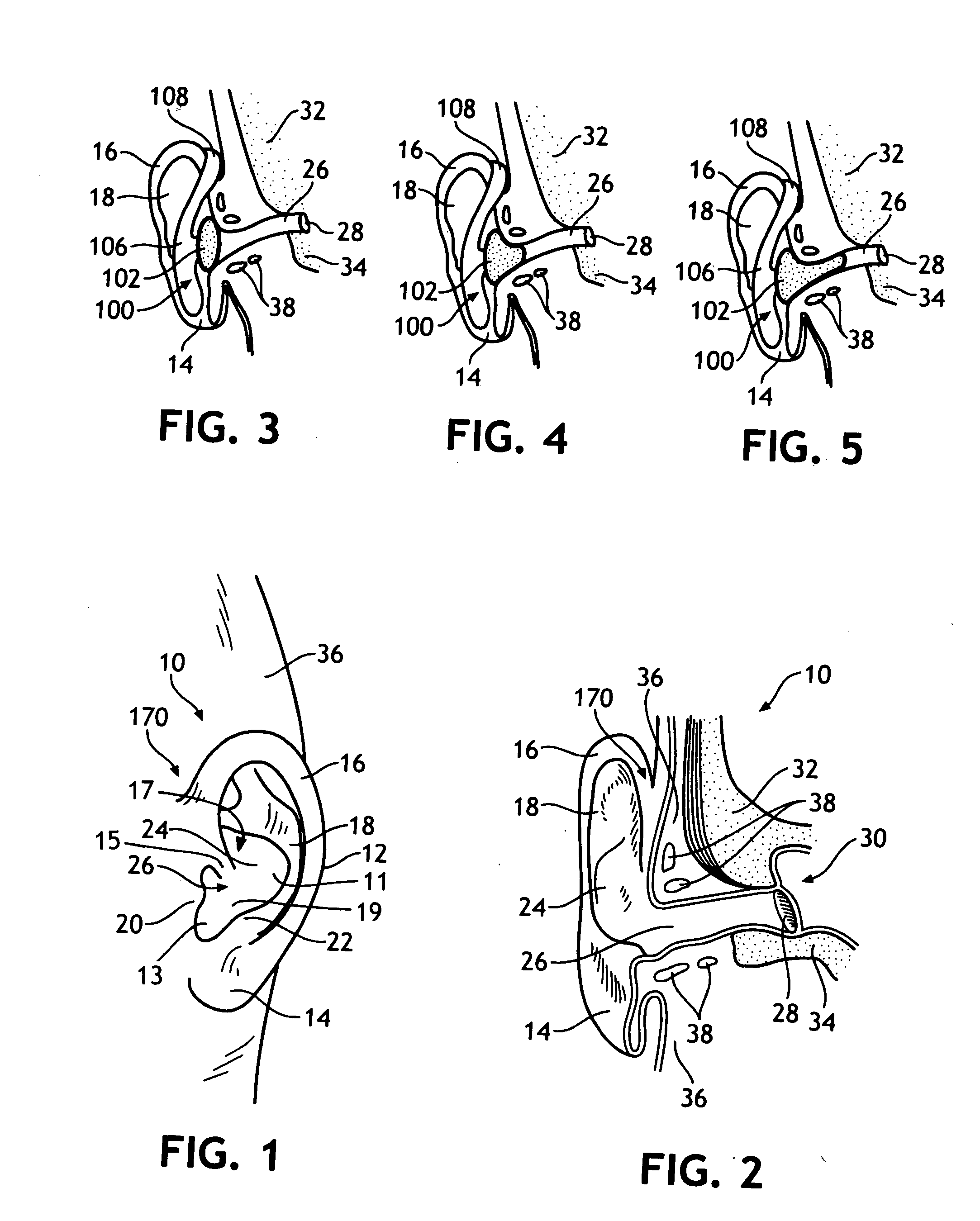 Bandless hearing protector and method