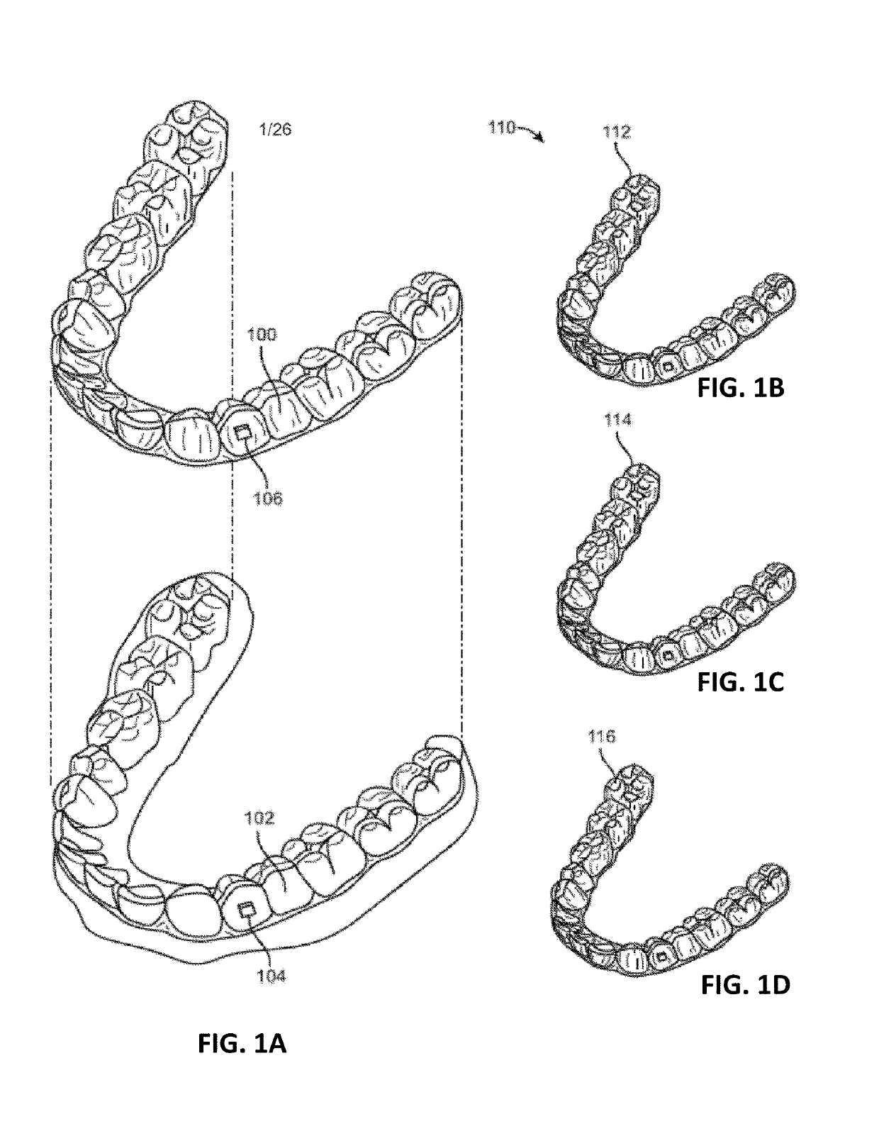 Intraoral appliances with sensing