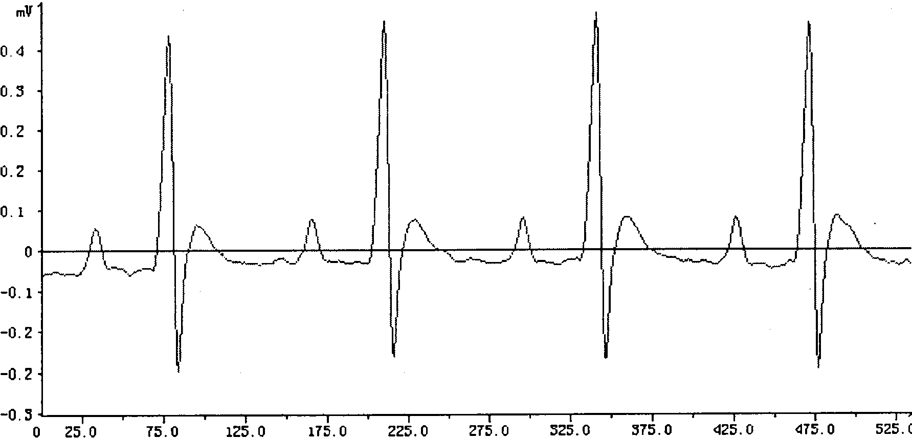 Application of coptisine in preventing and curing myocardial ischemic diseases