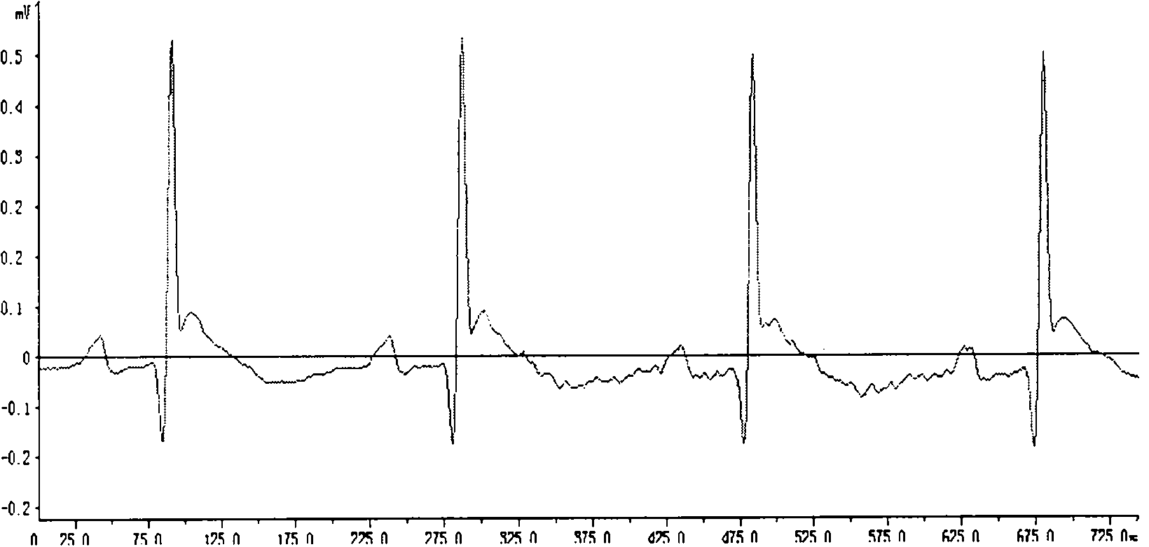 Application of coptisine in preventing and curing myocardial ischemic diseases