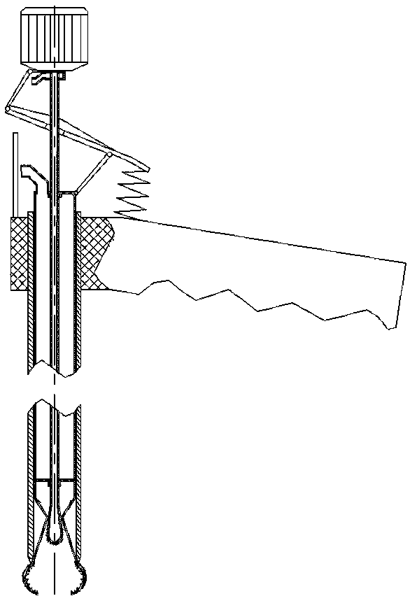 Calculus breaking device for urinary surgery