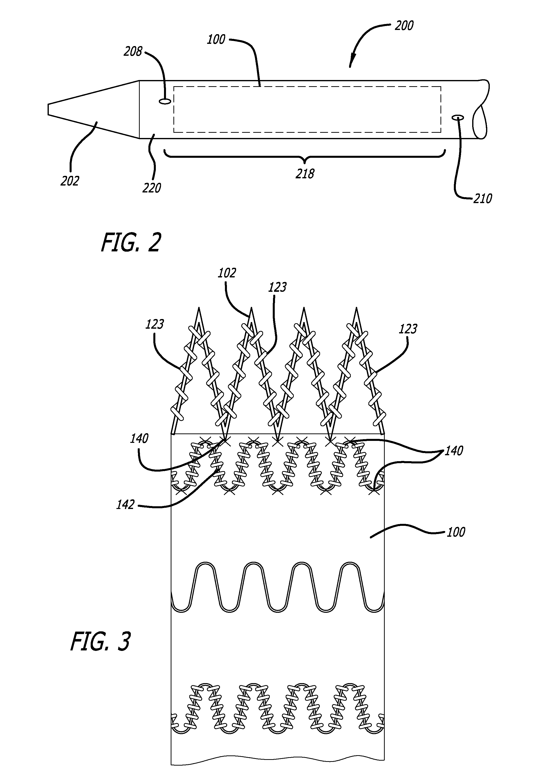 Methods and Devices for Contributing to Improved Stent Graft Fixation