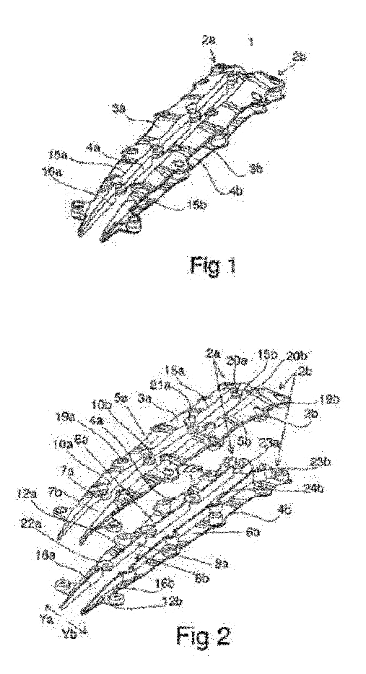 Split sternum prosthesis