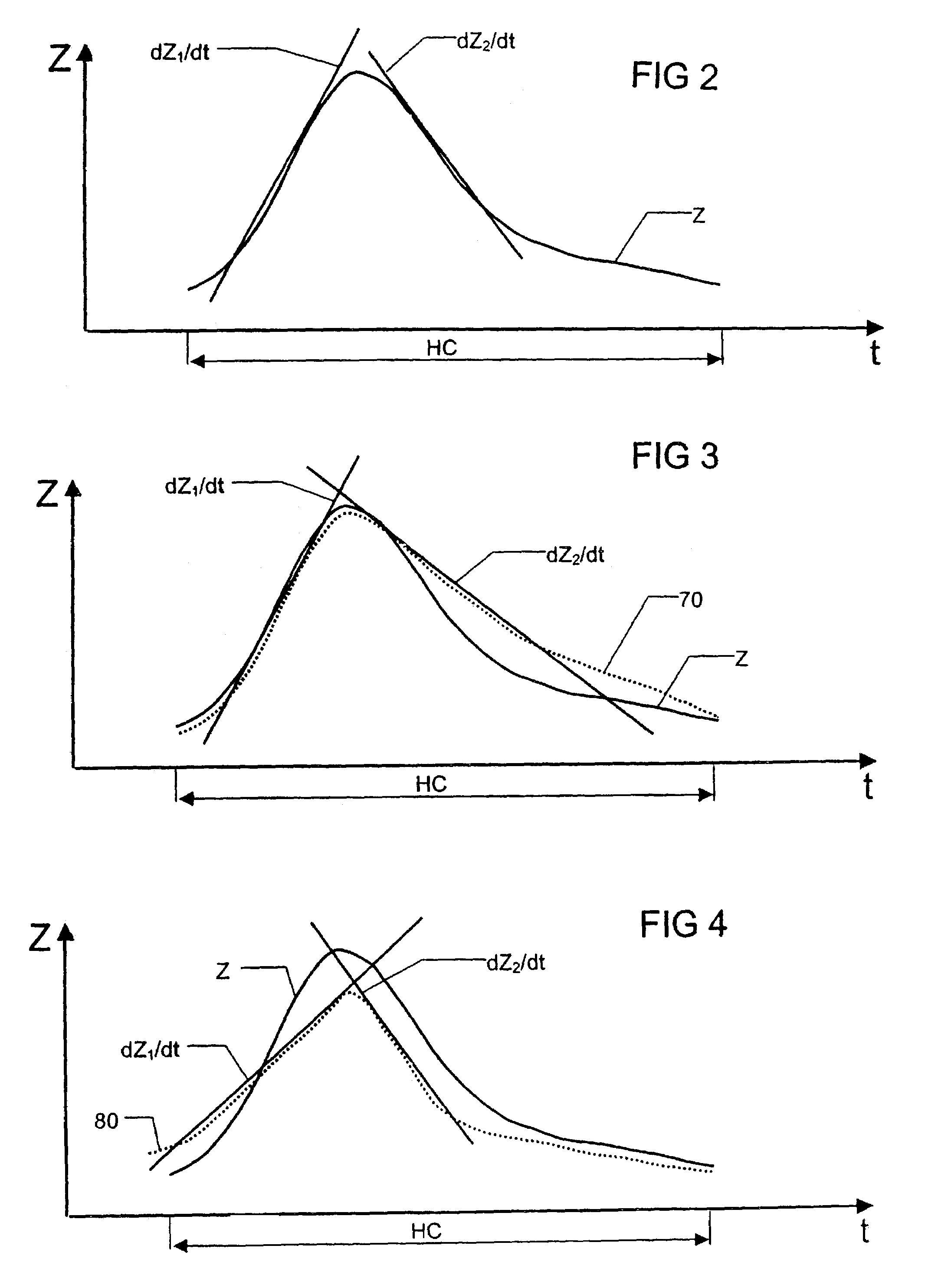 Systolic function monitoring utilizing slope of measured impedance