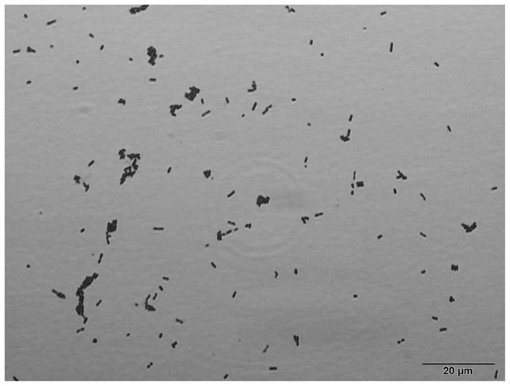 Lactobacillus plantarum and application of lactobacillus plantarum in preparation of medicines for treating infectious vaginosis