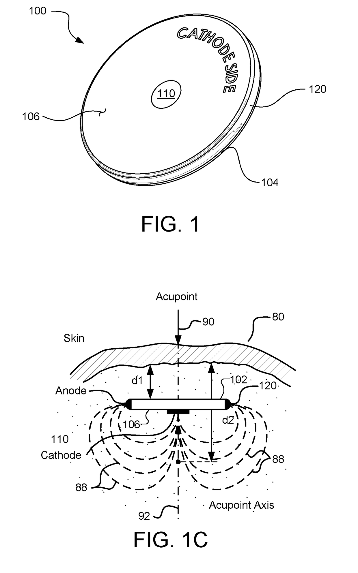 Methods and Systems for Treating a Chronic Low Back Pain Condition Using an Implantable Electroacupuncture Device