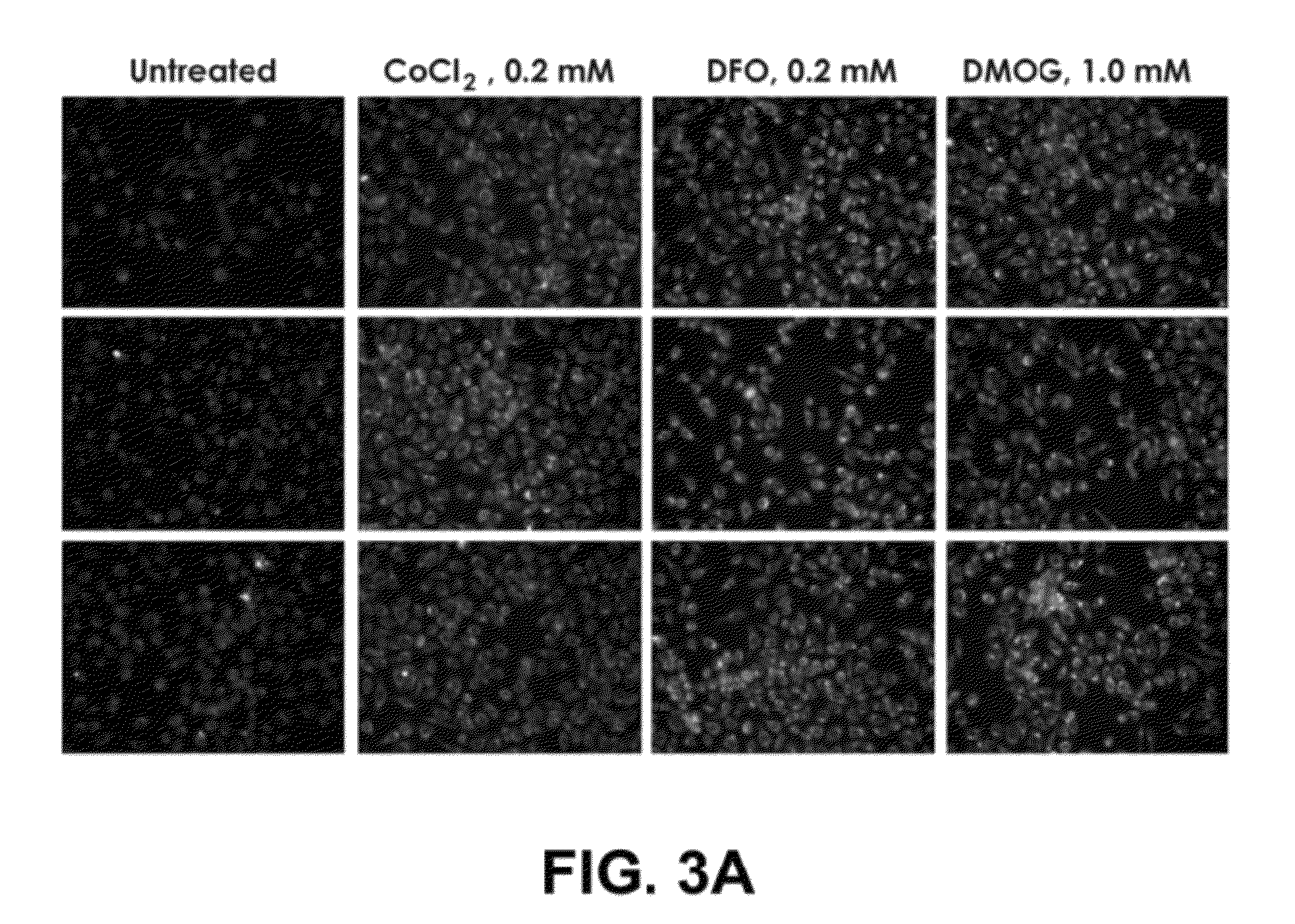 Self-immolative probes for enzyme activity detection