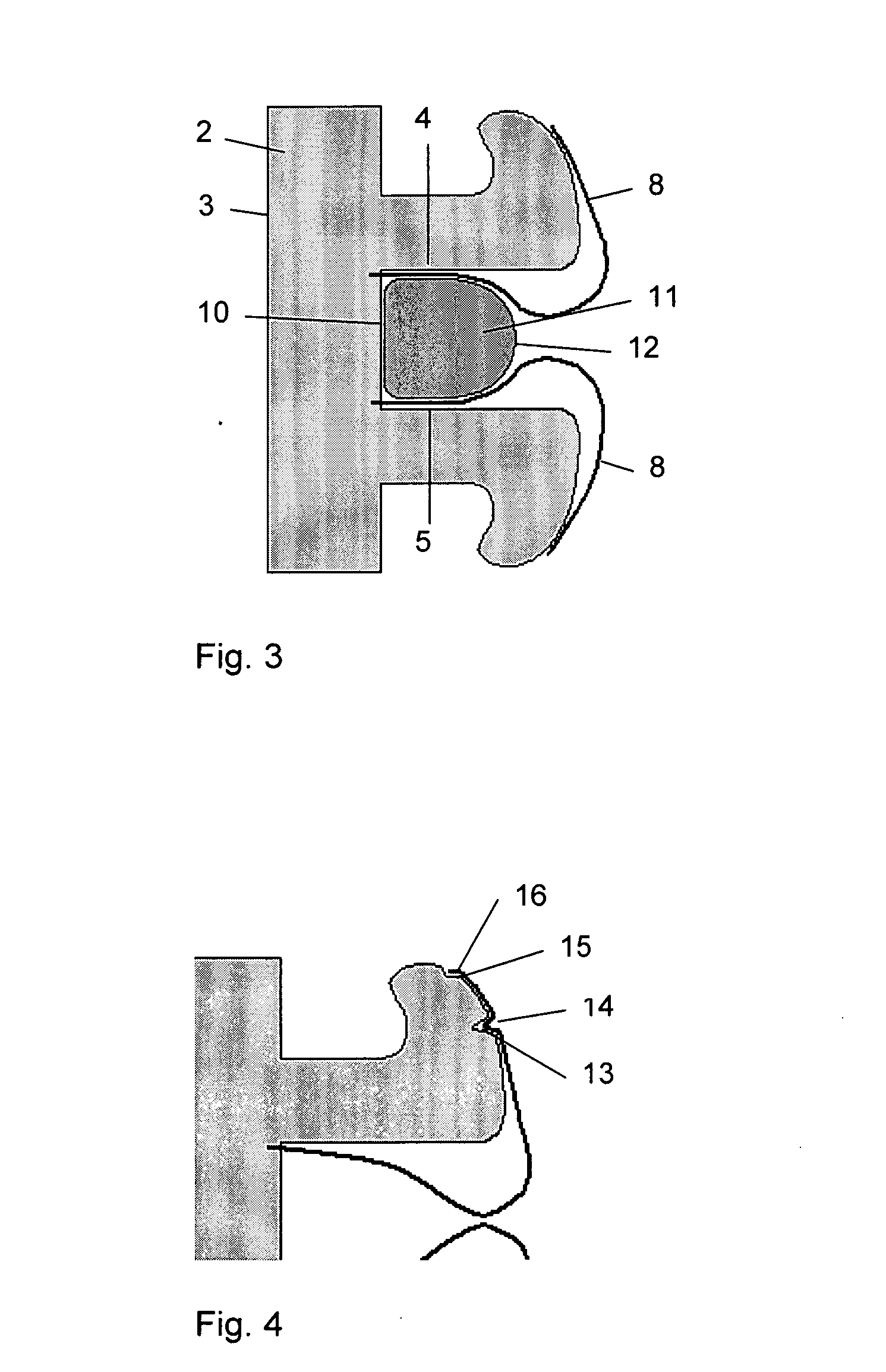 Orthodontic bracket