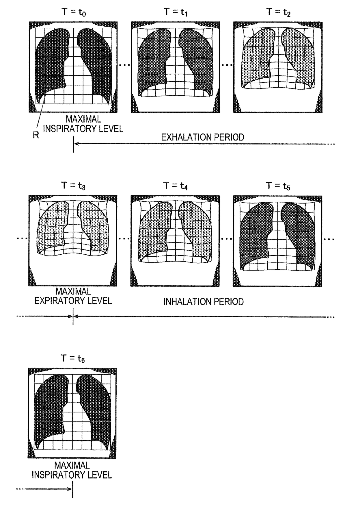 Radiographic-Image Processing Apparatus