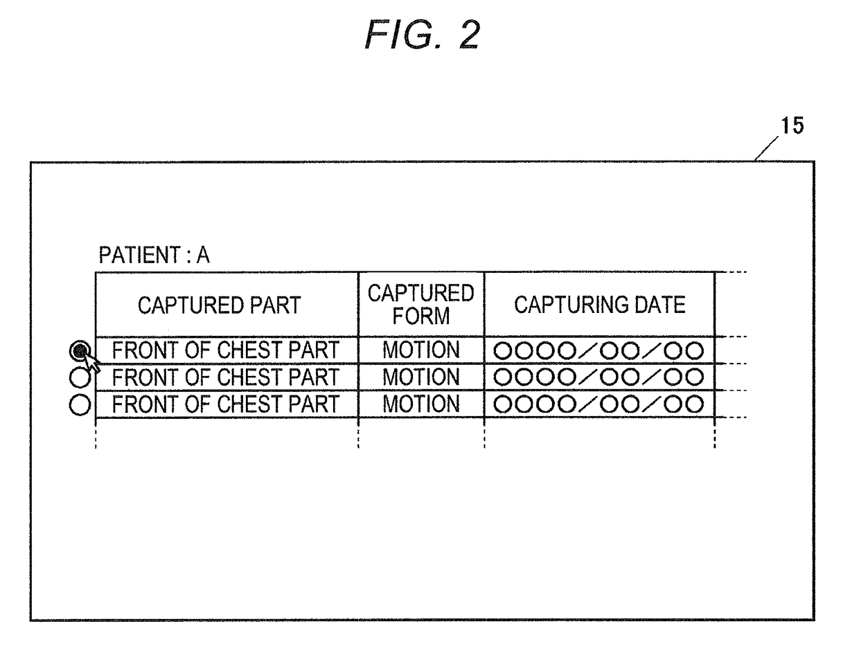 Radiographic-Image Processing Apparatus