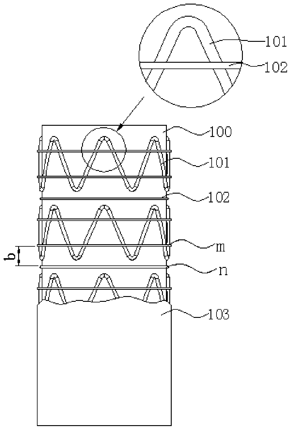 Stent Graft