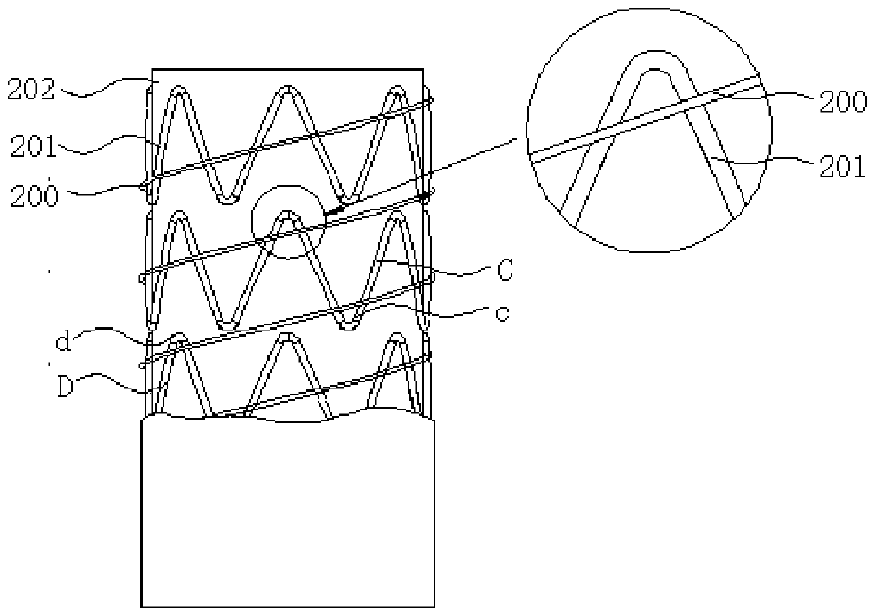 Stent Graft