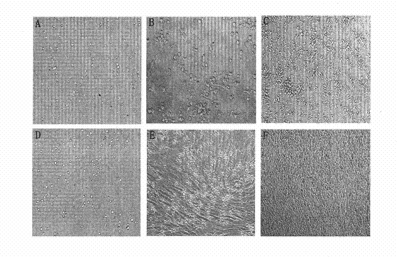 Immunologic tolerance dendritic cell, preparation method thereof and special culture medium