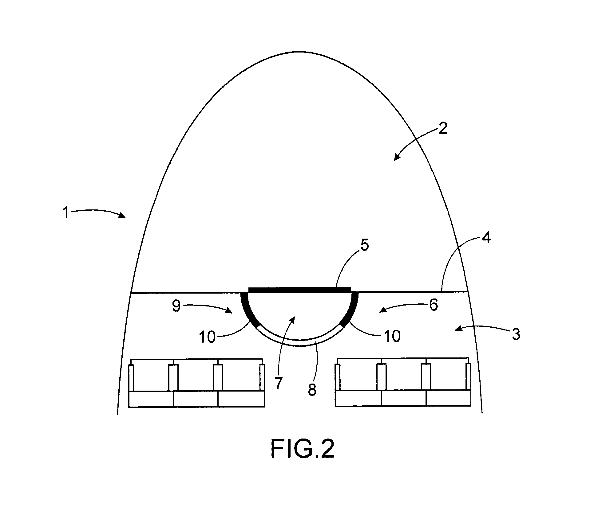 Aircraft nose section including a lock for accessing the cockpit