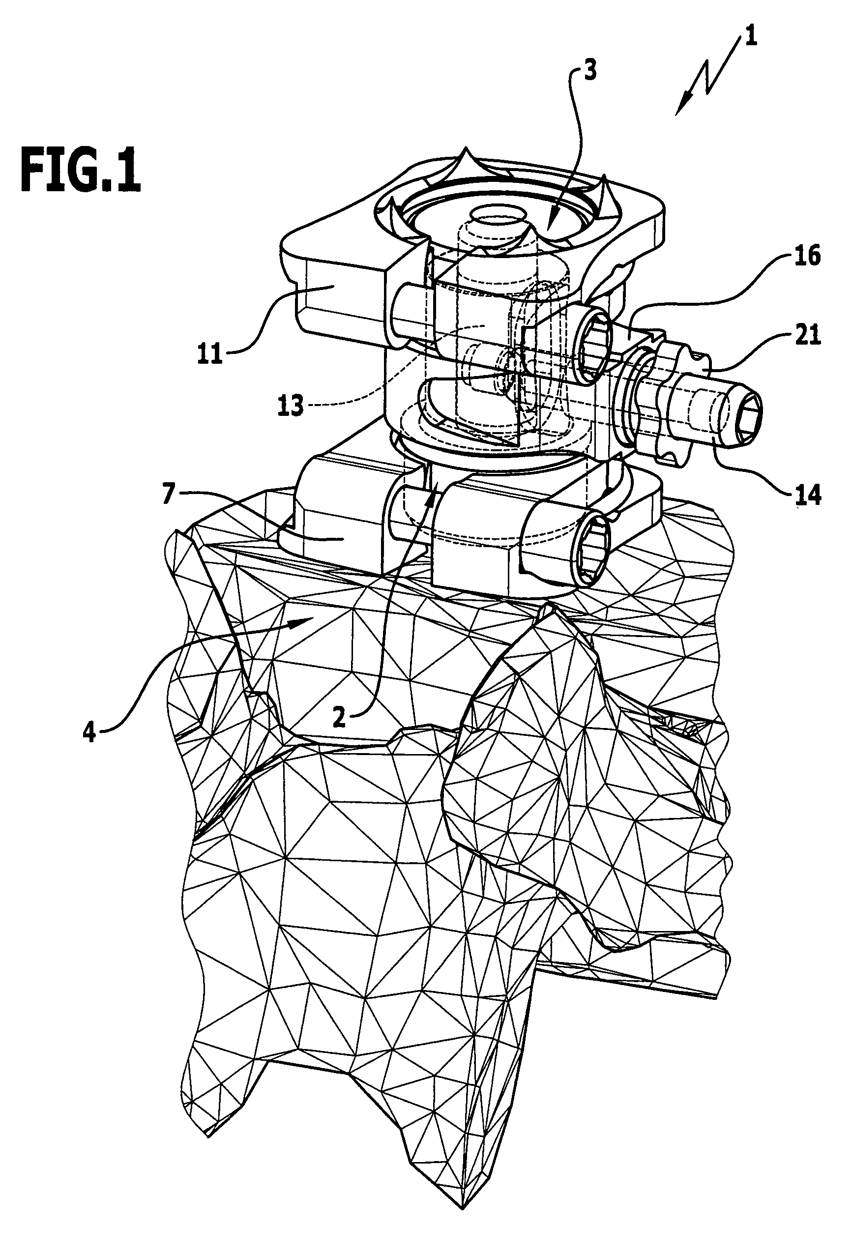 Vertebral body replacement implant