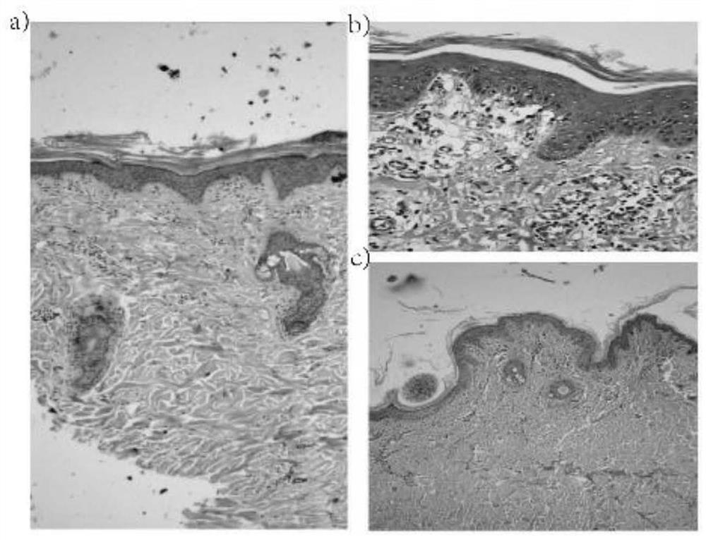 Application of scutellarin in preparation of medicine for treating burns and scalds