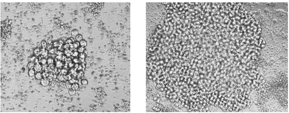 Monoclonal antibody against mycoplasma bovis, hybridoma cell line secreting the monoclonal antibody and application