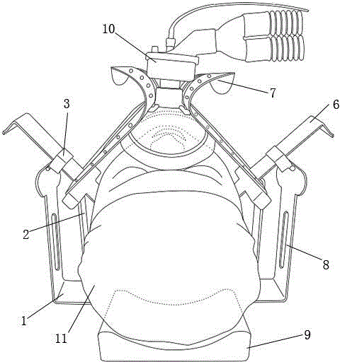 Synchronous fixing rack for mandible mask