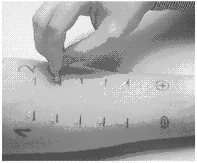 Fast insertion gun for allergy test