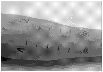 Fast insertion gun for allergy test