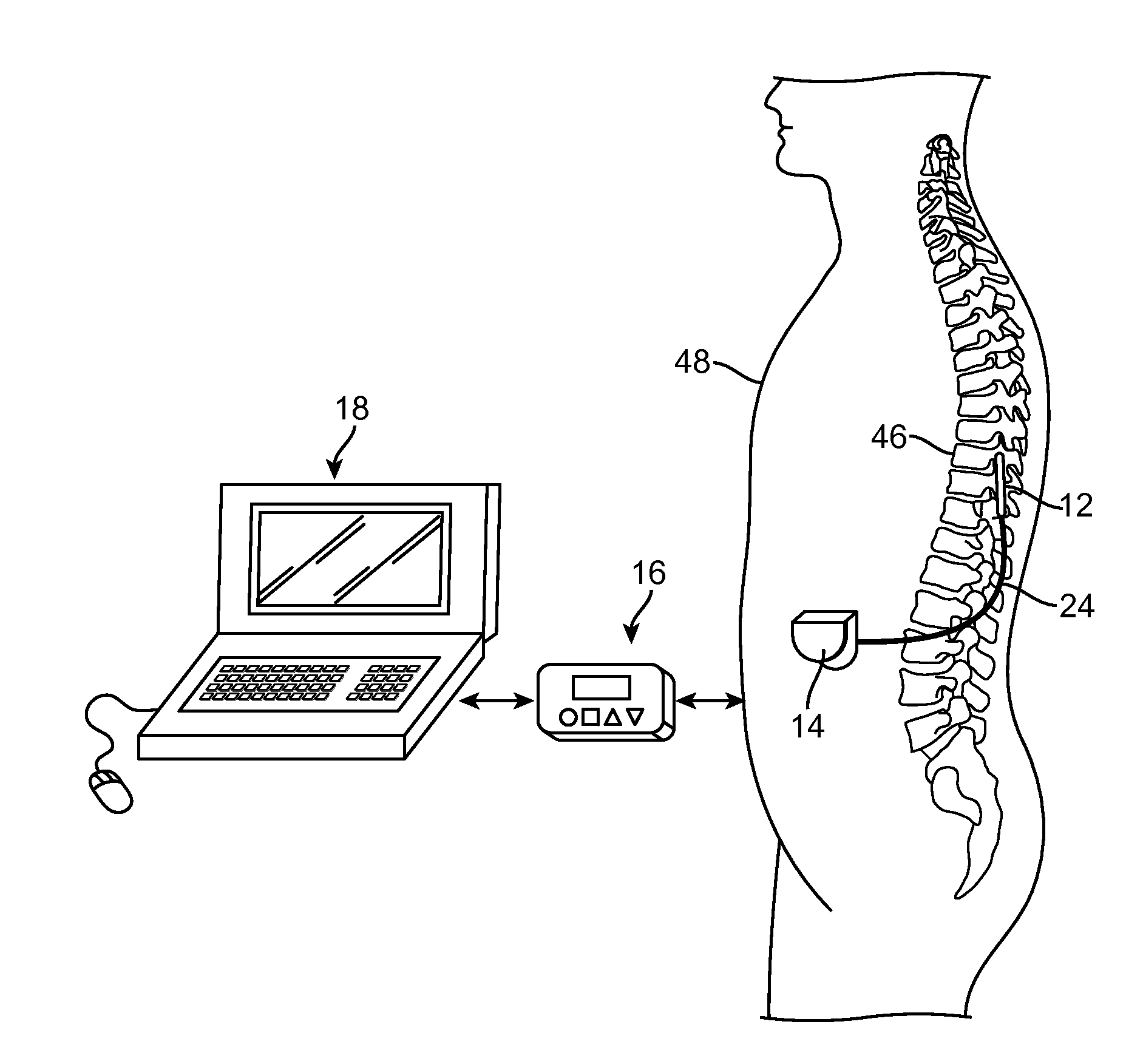 System and method for shaped phased current delivery