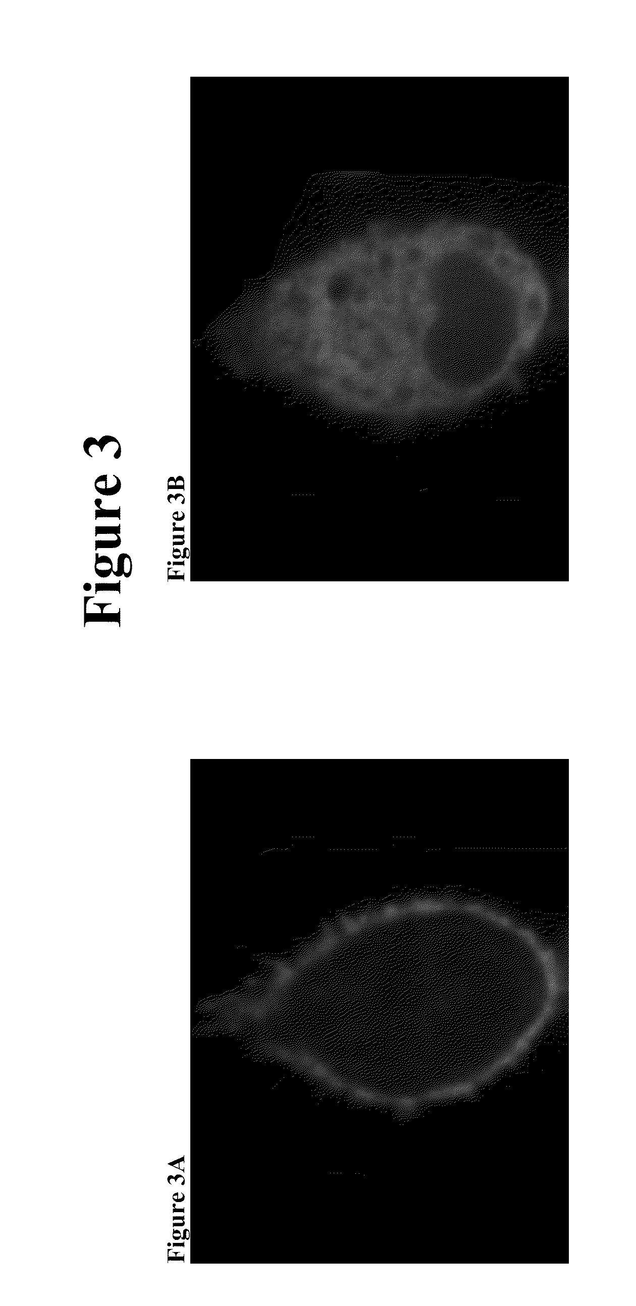 Formulations comprising aminosterols