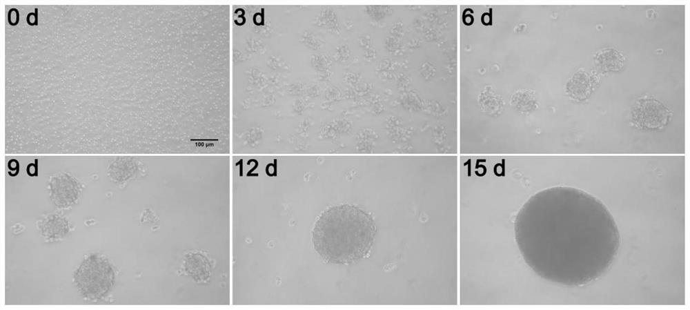 Method for culturing primary epithelial stem cell spheres from mouse lung tissue