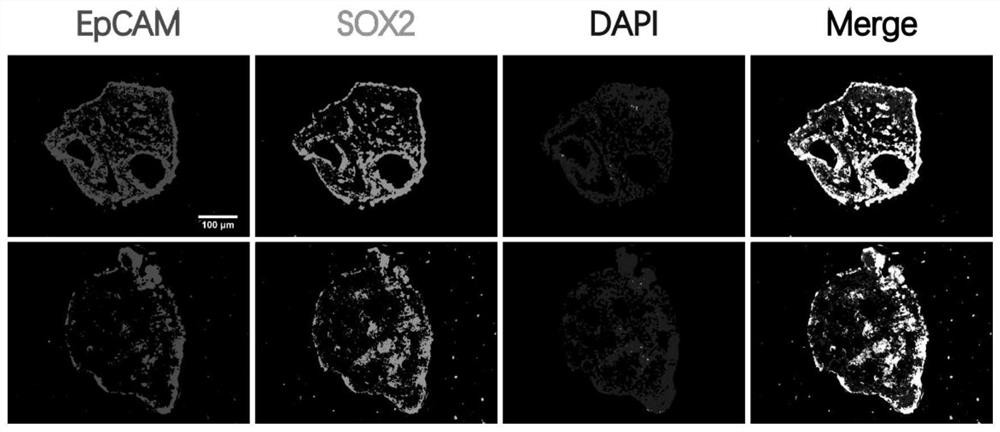 Method for culturing primary epithelial stem cell spheres from mouse lung tissue