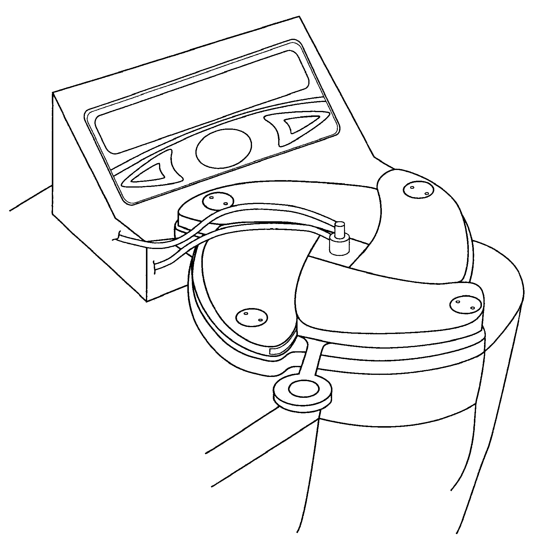 Blood separation and concentration system