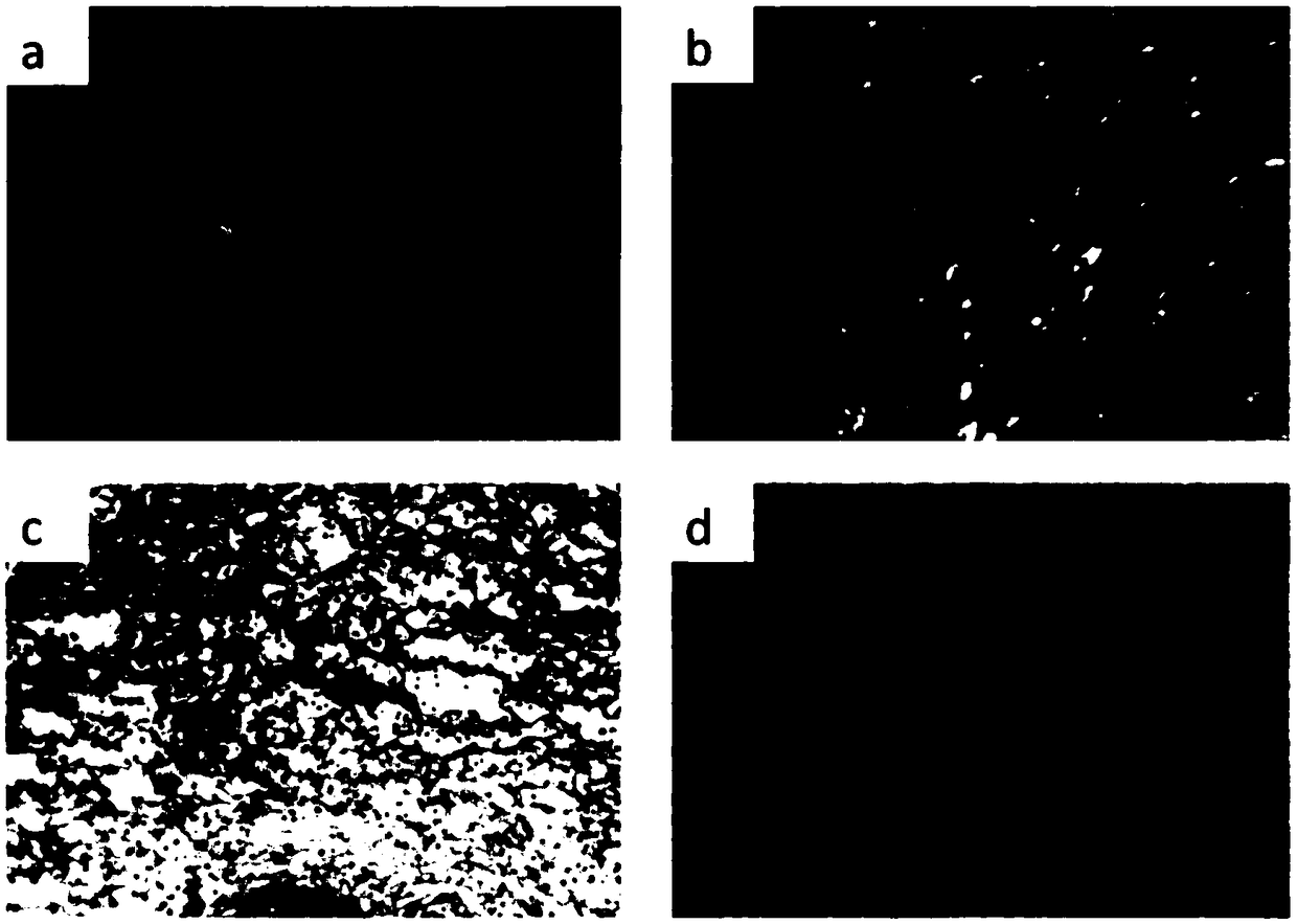 Artificial dermis