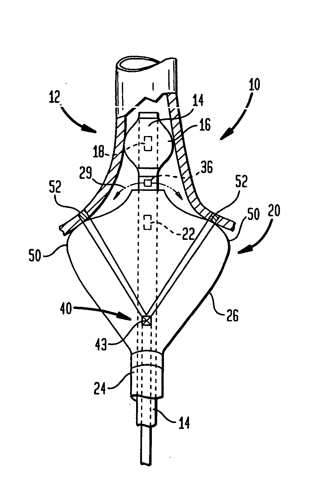 Coaxial catheter instruments for ablation with radiant energy