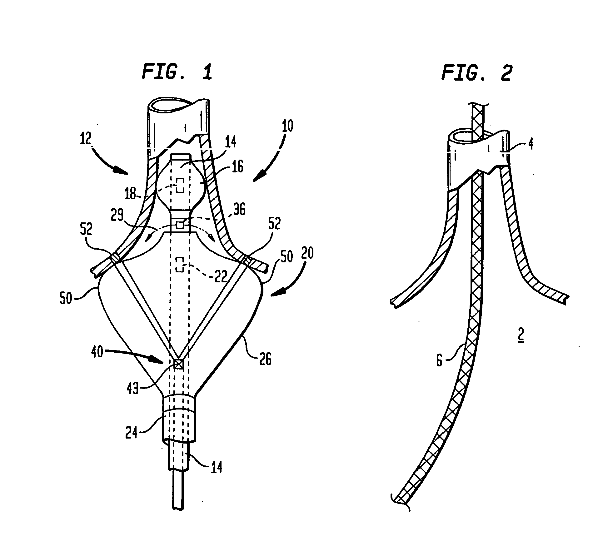 Coaxial catheter instruments for ablation with radiant energy