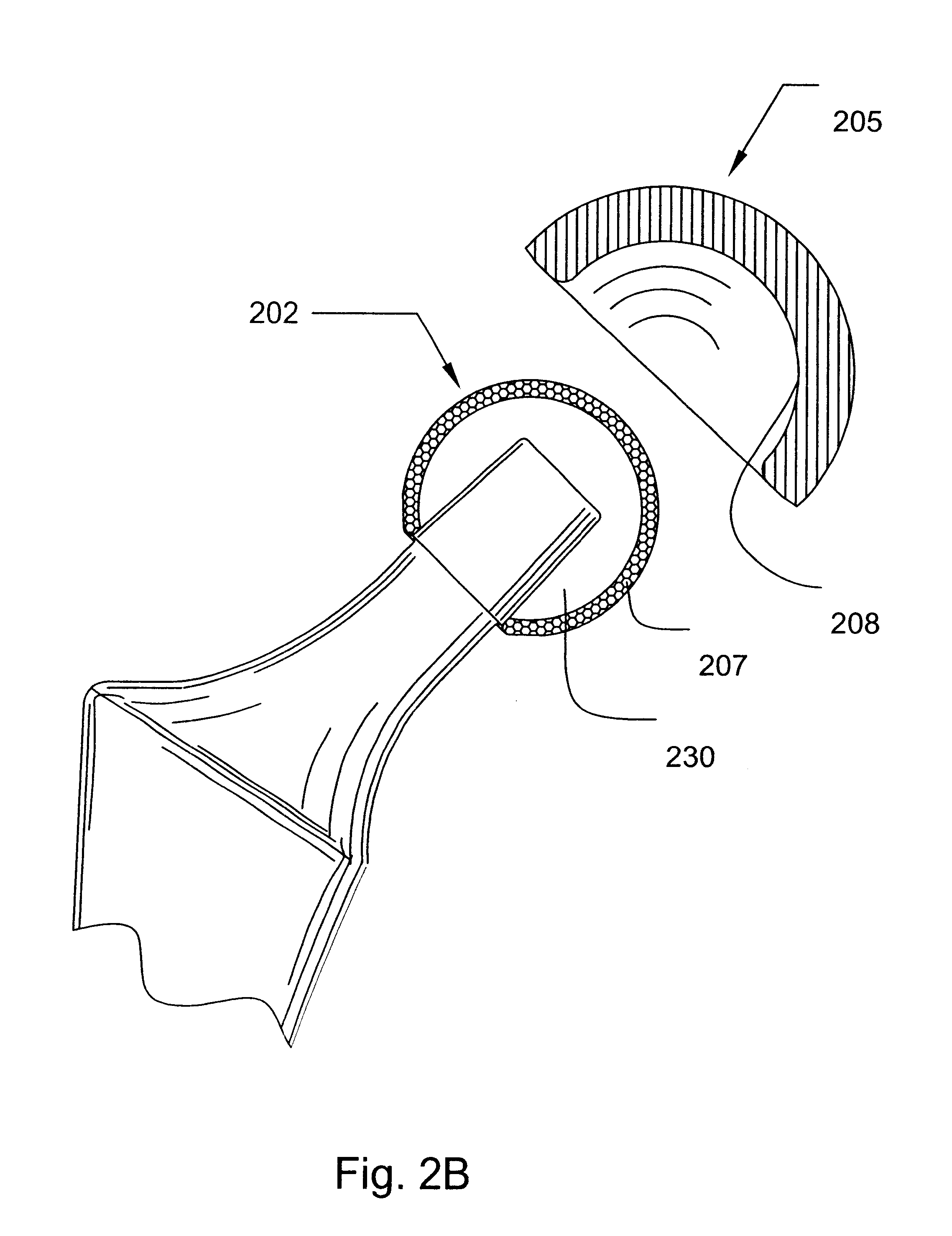 Prosthetic hip joint having at least one sintered polycrystalline diamond compact articulation surface and substrate surface topographical features in said polycrystalline diamond compact