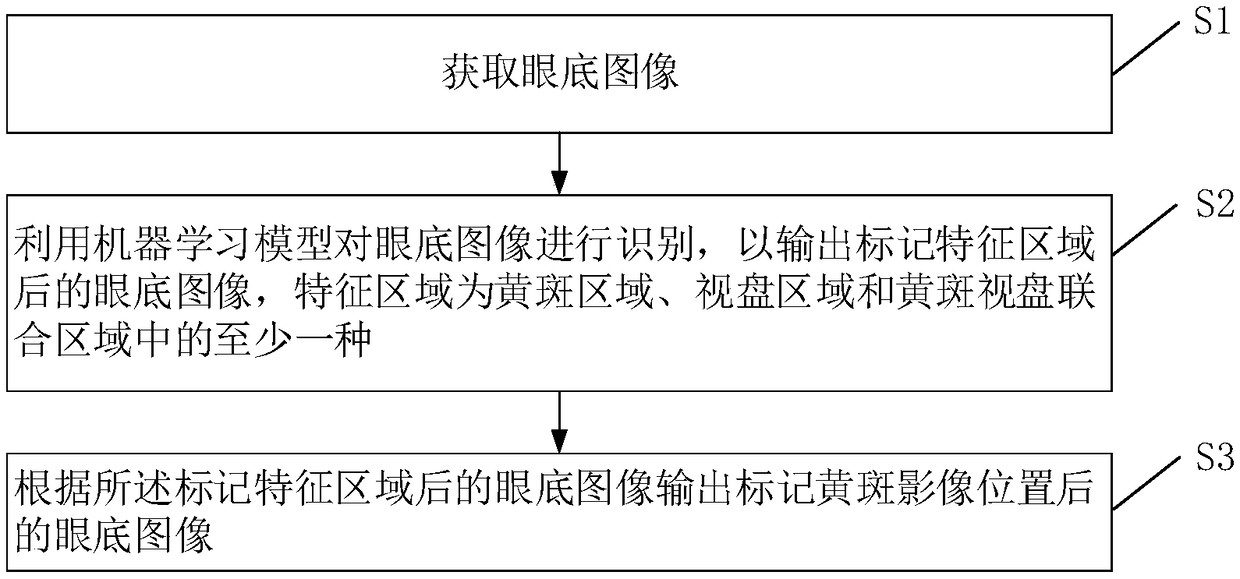 Macula lutea image detection method and equipment