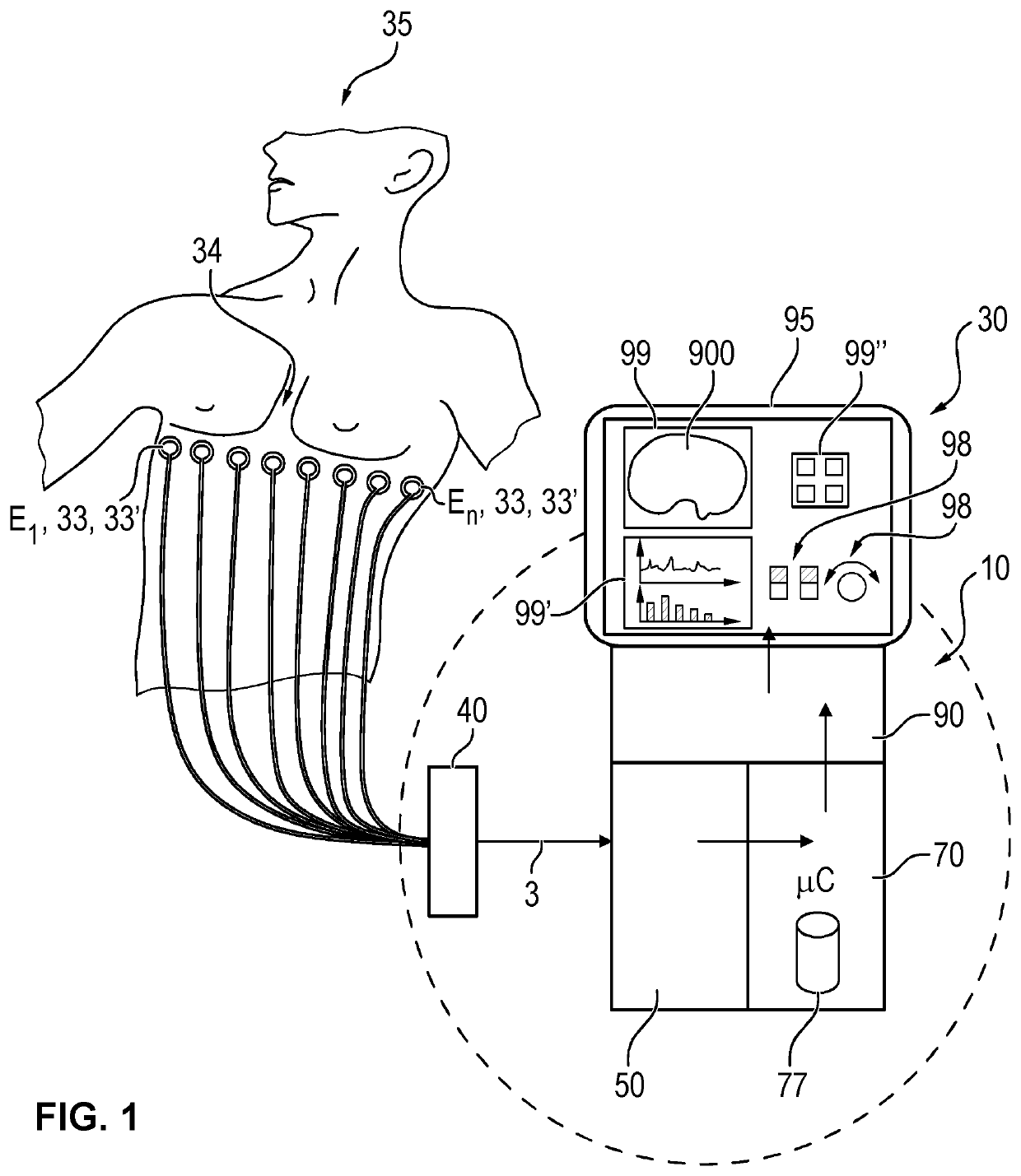 Device and process for electrical impedance tomography (EIT) with identification of a heart region