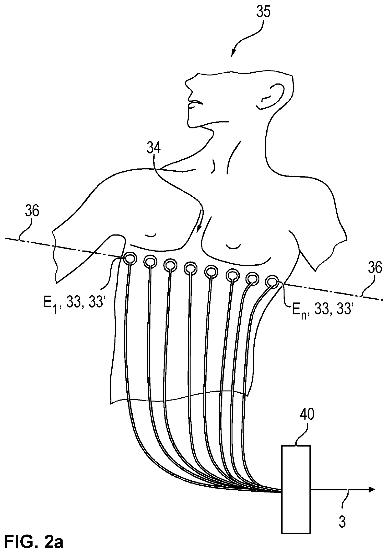 Device and process for electrical impedance tomography (EIT) with identification of a heart region