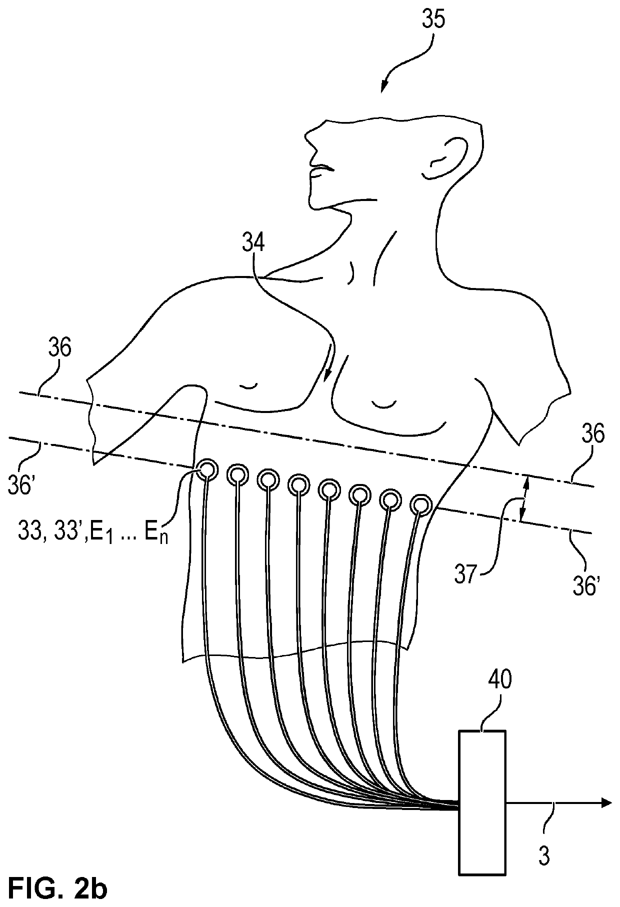 Device and process for electrical impedance tomography (EIT) with identification of a heart region