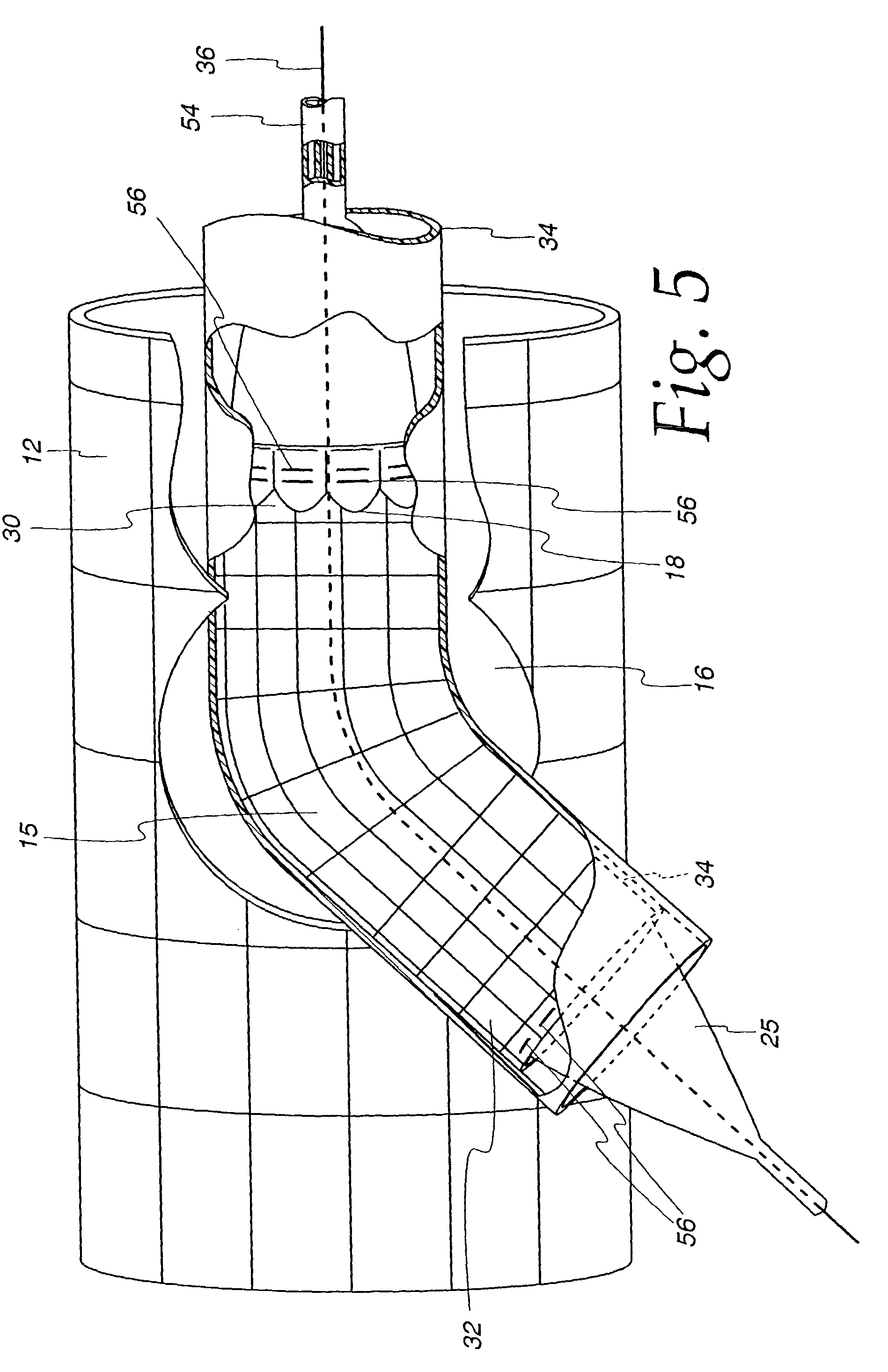 Extendible stent apparatus