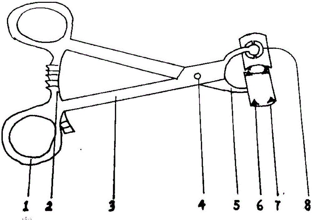 In-situ rotary bone fracture restoration fixer