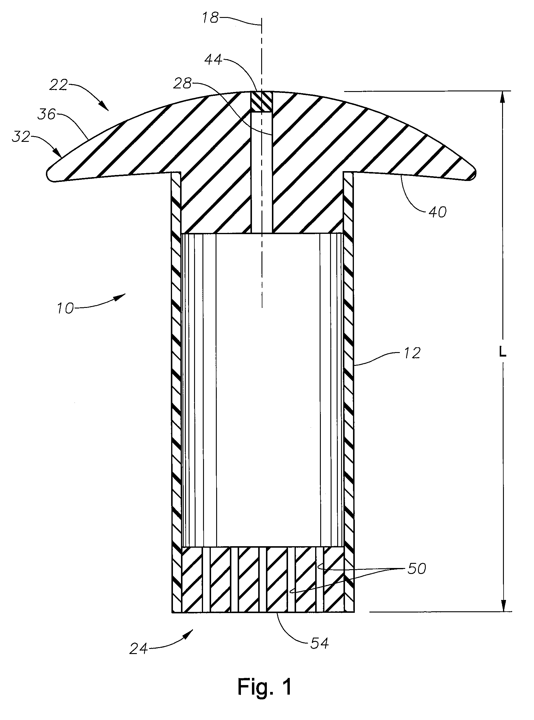 In-situ refillable ophthalmic implant