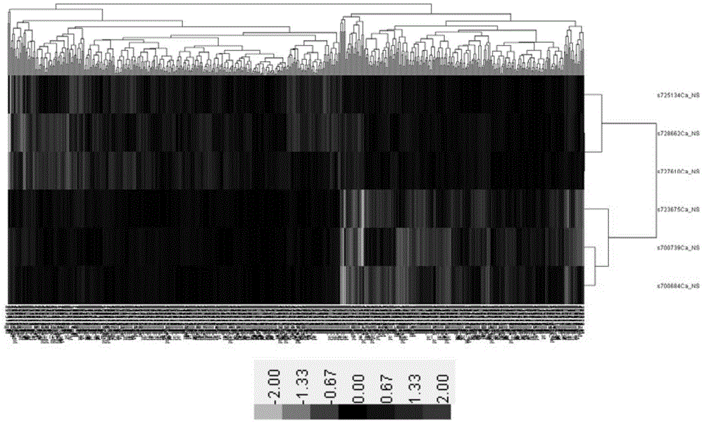 Application of stc2 gene as a molecular marker for colorectal cancer liver metastasis