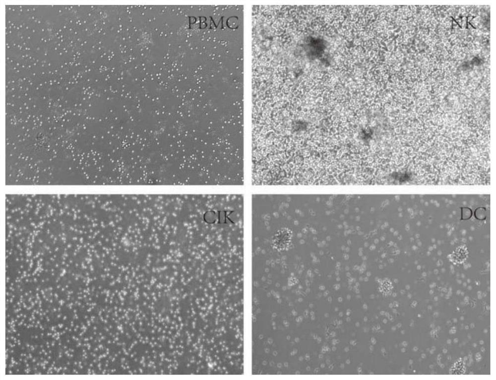 Immune cell freezing medium and preparation method and application thereof