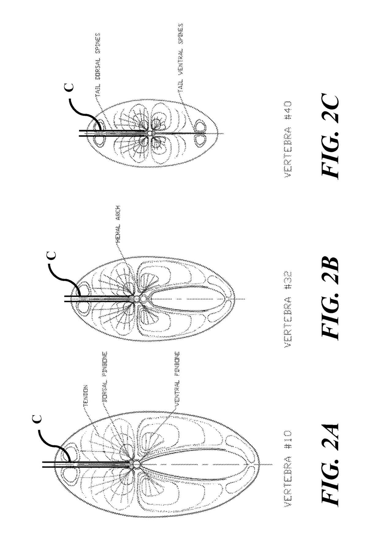 Fish processing systems and methods