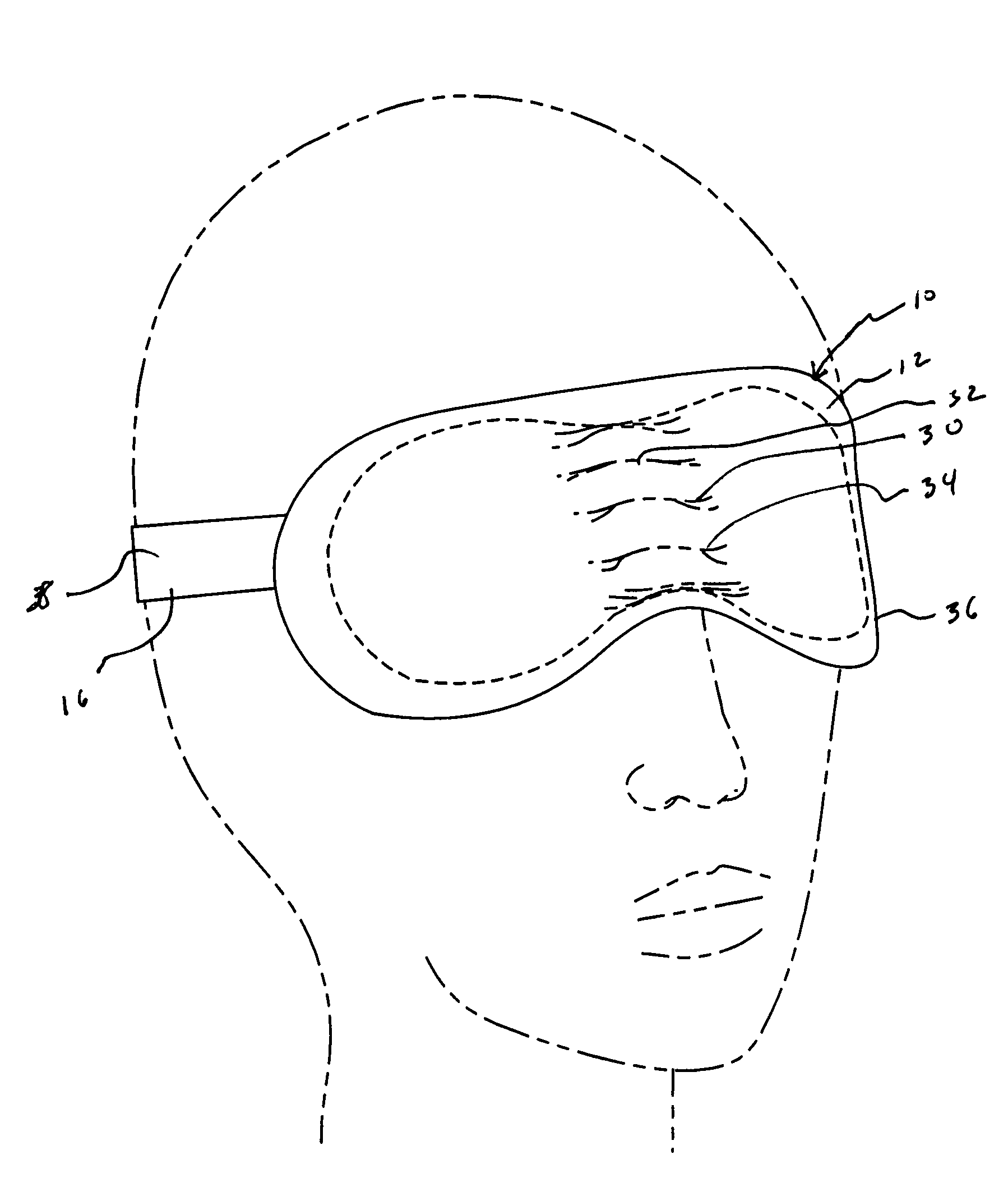 Disposable sleep mask for treating dry eye syndrome