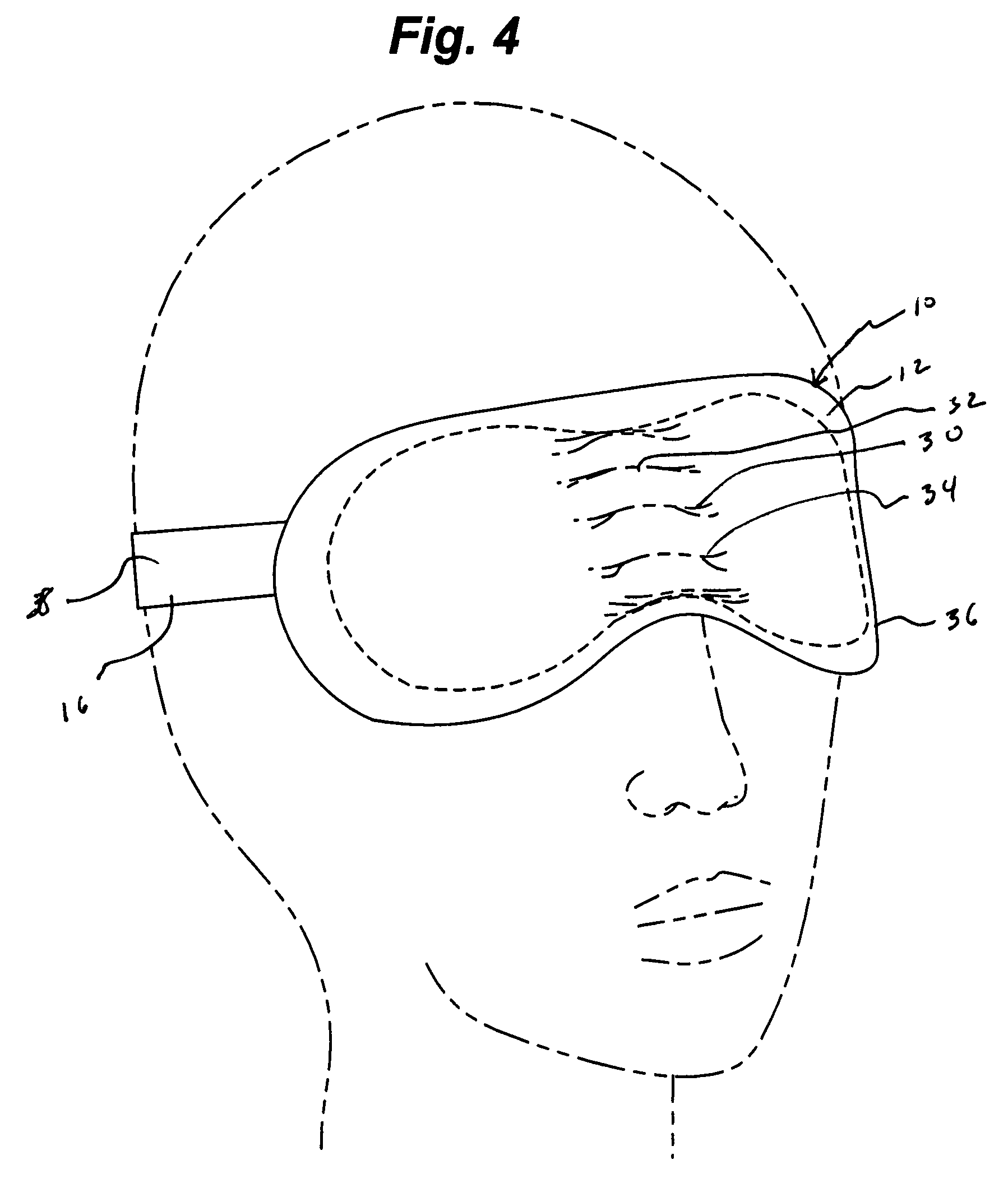 Disposable sleep mask for treating dry eye syndrome