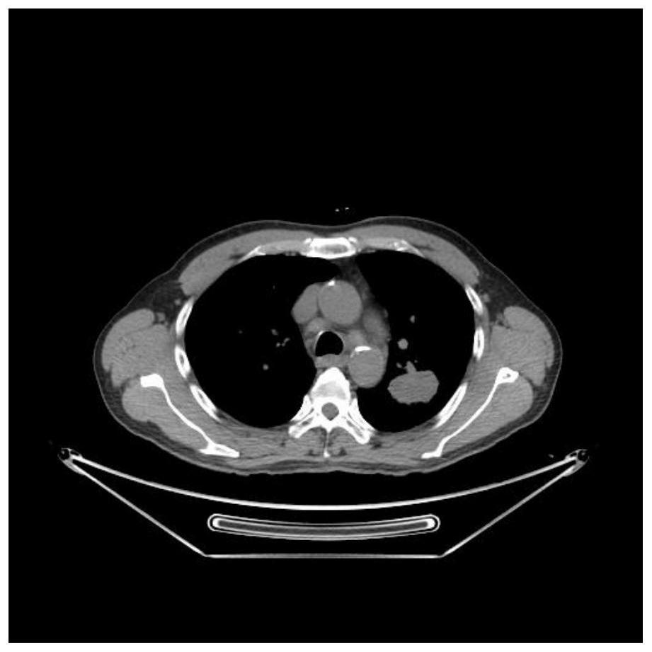 An annotation extraction method for medical imaging lesions that can improve doctor efficiency