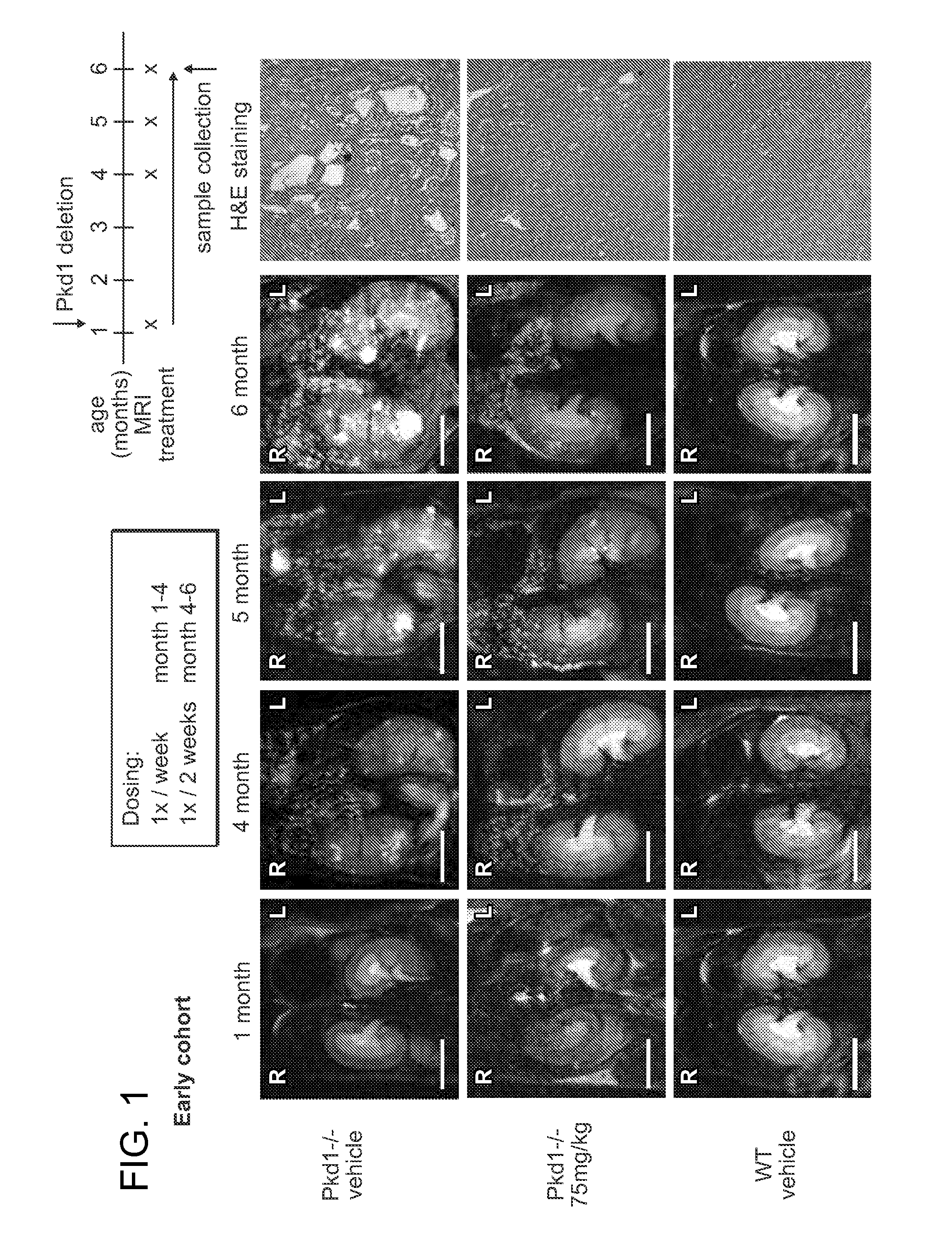 Treating polycystic kidney disease with hsp90 inhibitory compounds