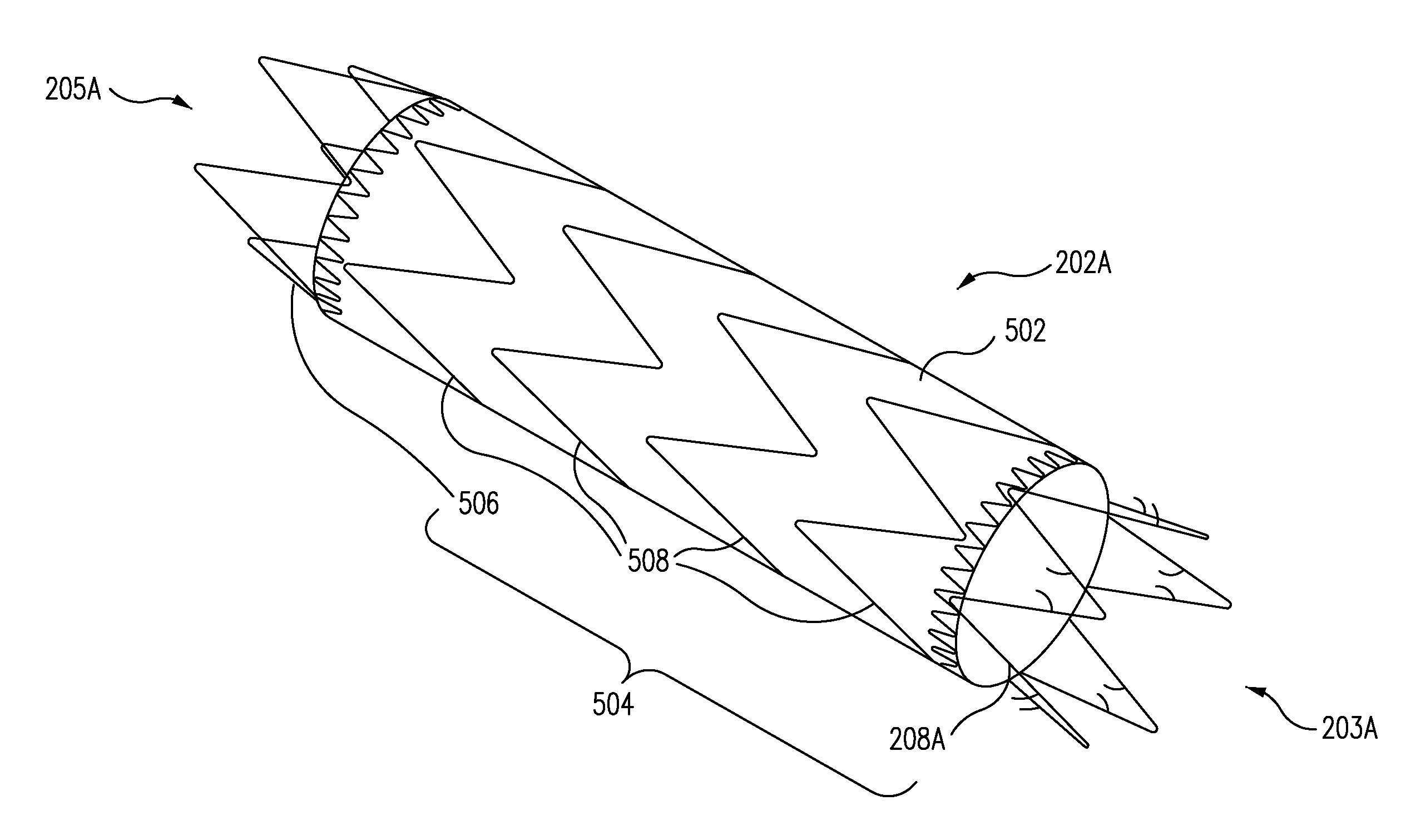 Stent-Graft With Anchoring Pins